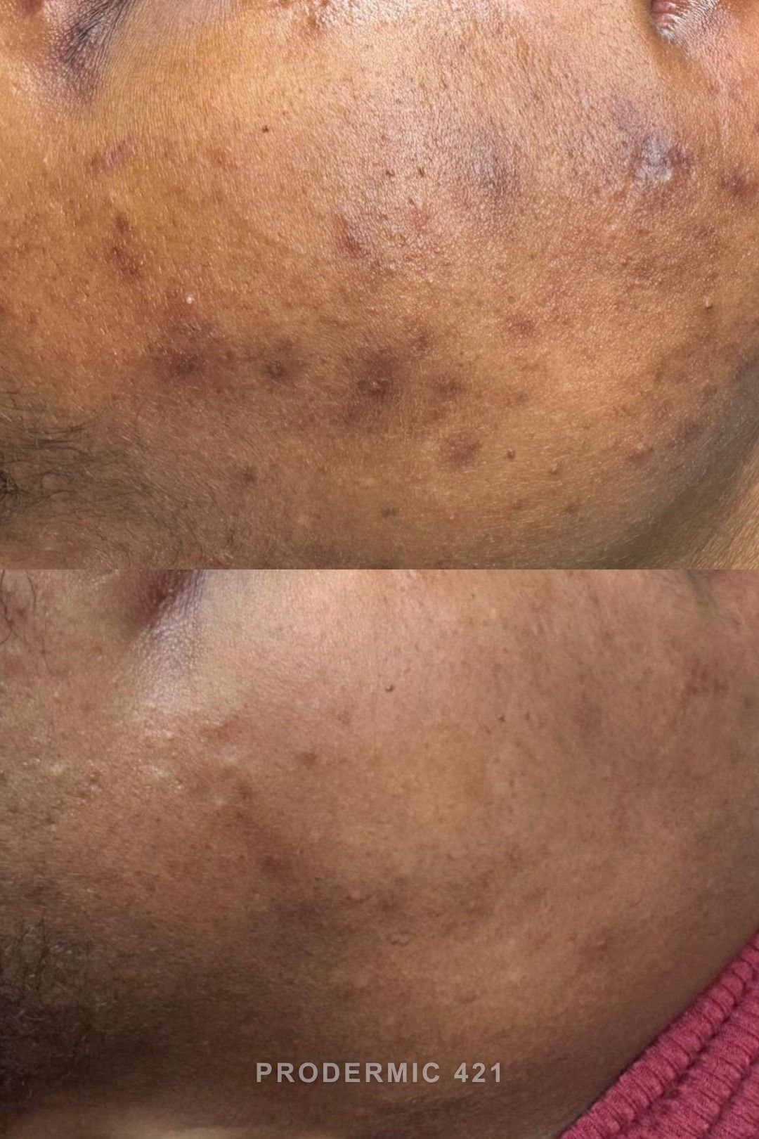 prodermic 420 Detox Protocol image 3